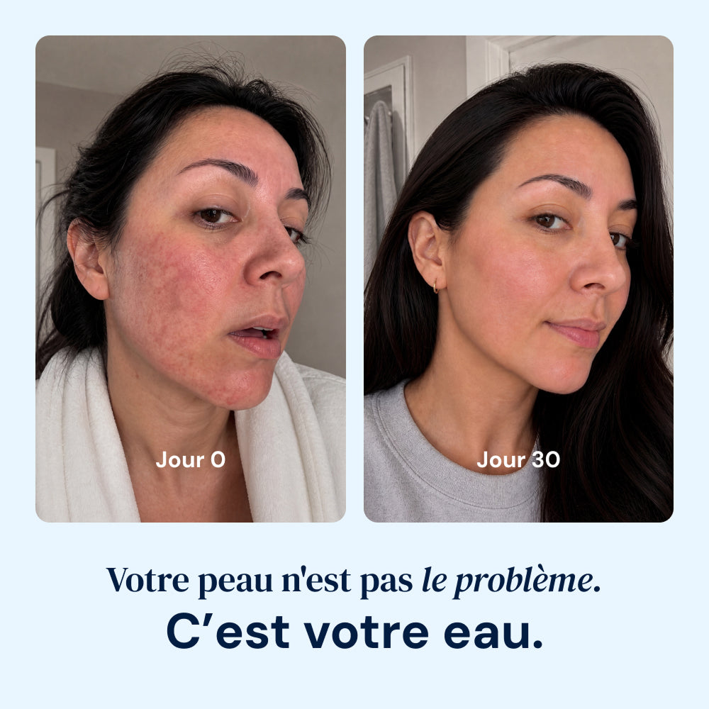 Filtre de douche Hellopur®